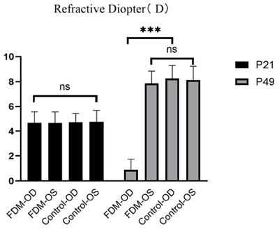 Effect of shape deprivation on retinal thickness in myopic mice using an OCT method